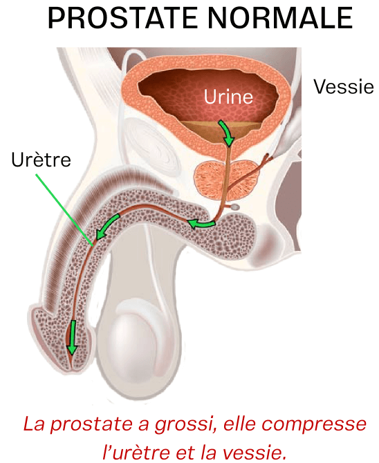 prostate normale